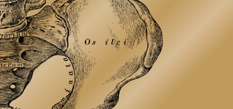 Missed hip fracture image